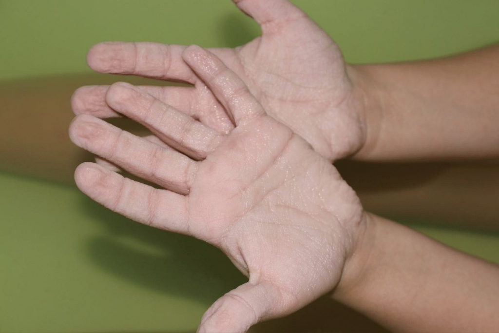 Perché le dita della mani raggrinziscono in acqua: il motivo sorprendente